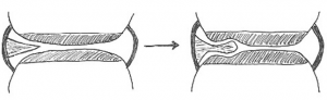 Spinal research steps - diagram