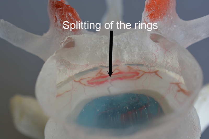 Splitting of rings