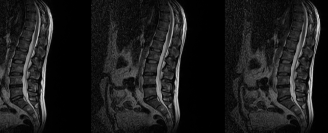 Motion sharing and spine models